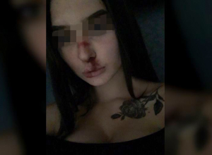 Разбитый парнем за измену нос юной красавицы вызвал бурю обсуждений волгоградцев Разбитый парнем за измену нос юной красавицы вызвал бурю обсуждений волгоградцев