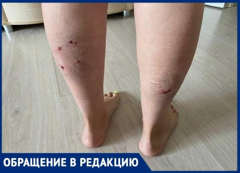 Свора собак искусала волгоградку: девушка закрыла собой коляску с 10-месячной дочкой Свора собак искусала волгоградку: девушка закрыла собой коляску с 10-месячной дочкой